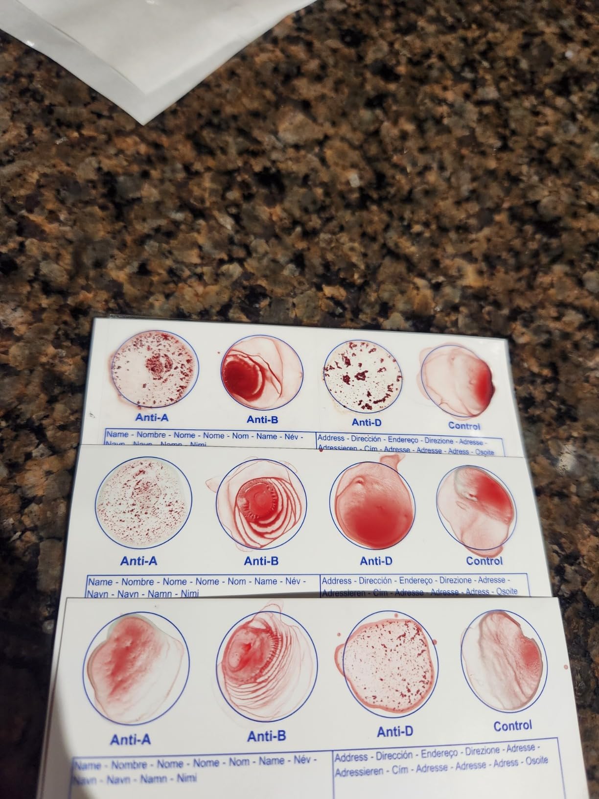 Eldoncard Blood Typing Kit, 5 Test Pack, Know Your Blood Type, Accurate Instant Home Testing, Determine A, O, B, Rhs-D Negative & Positive Groups customer photo 2