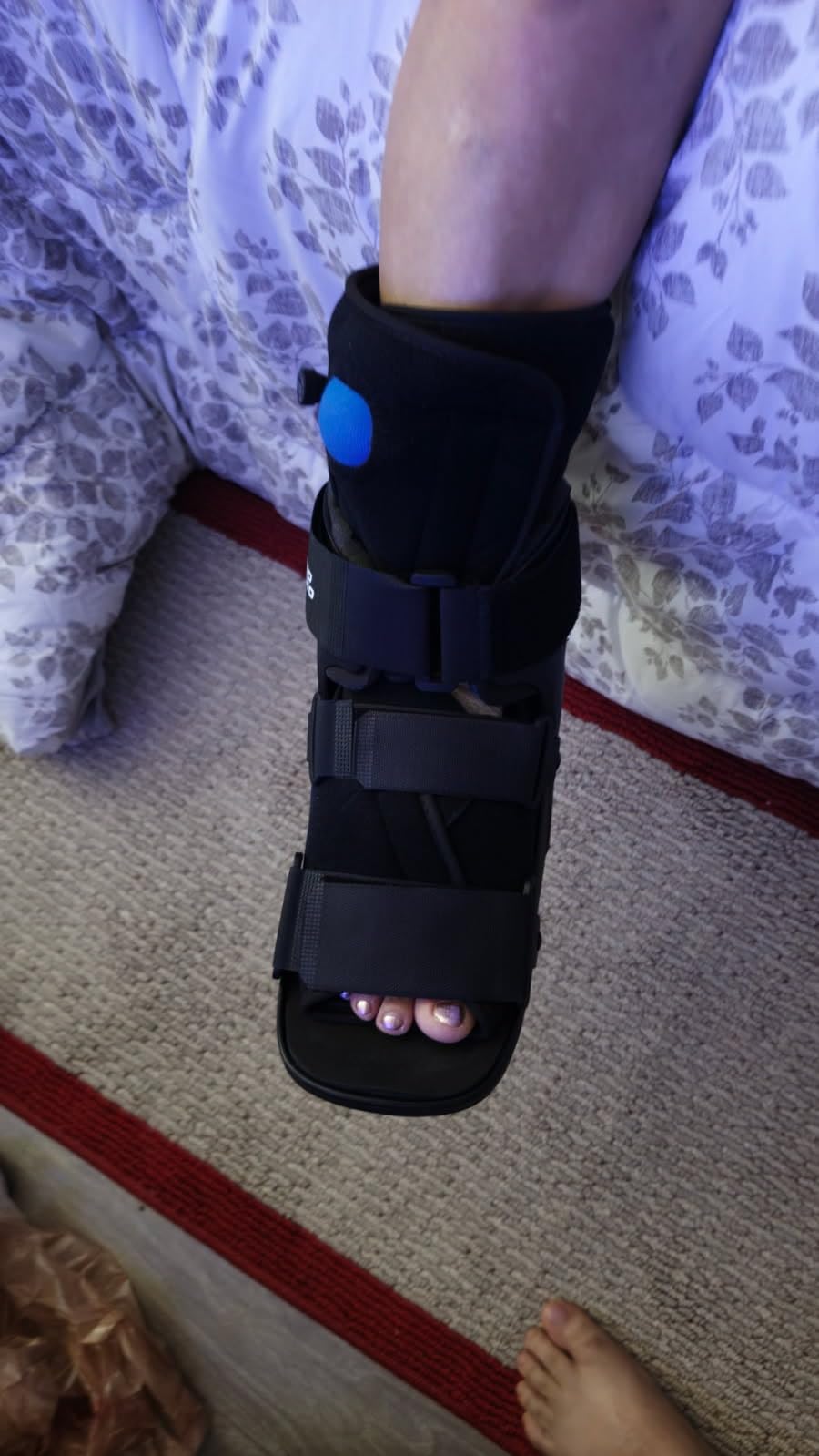 United Ortho Short Air Cam Walker Fracture Boot, Small, Black customer photo 2