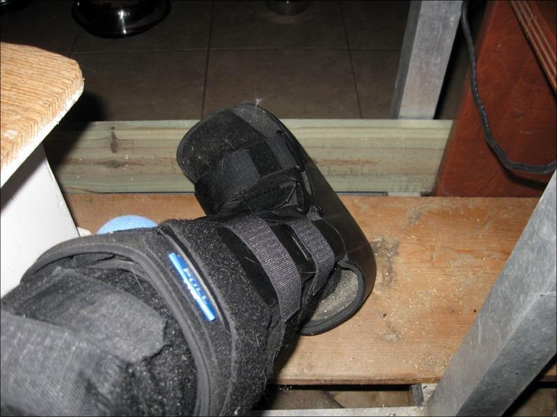 United Ortho Air Cam Walker Fracture Boot, Small, Black customer photo 2