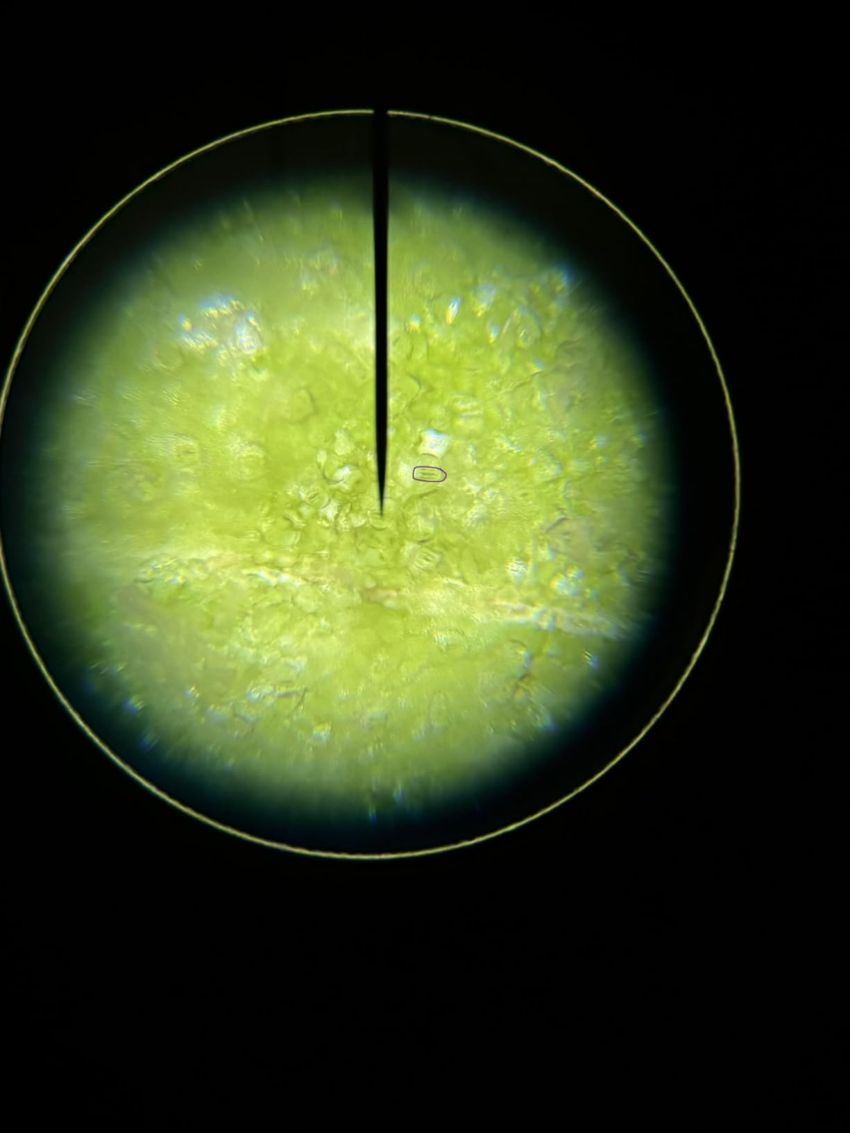 AmScope M150C 40X-1000X All-Metal Optical Glass Lenses Cordless LED Compound Biological Microscope customer photo 1