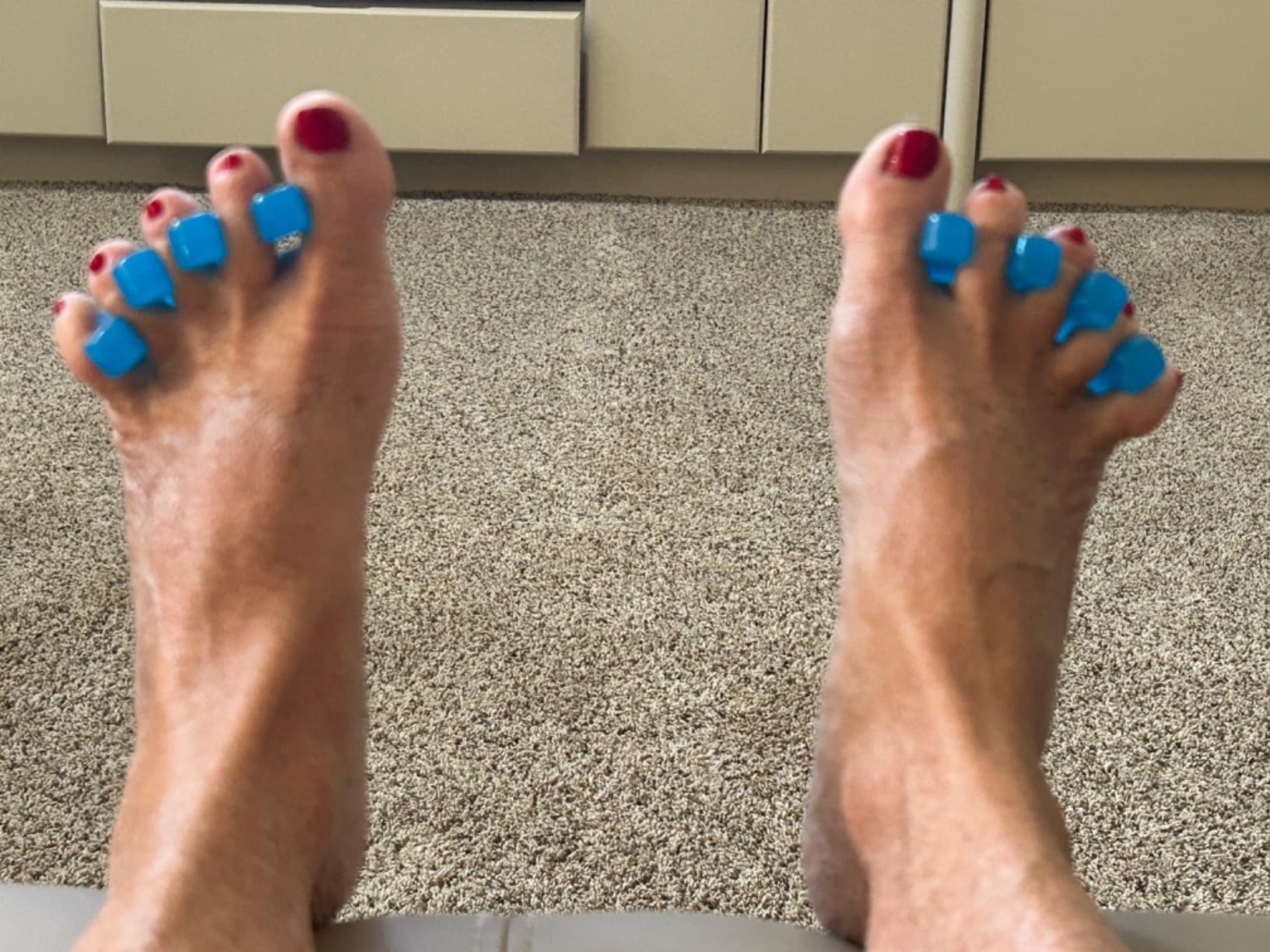 VIVEsole Toe Separators for Men & Women Medium (2 Pairs) - Silicone Gel Spreaders - Therapeutic Spa Stretchers for Plantar Fasciitis, Bunions, Overlapping Hammer Toe Spacers - Metatarsal Yoga Cushion customer photo 2