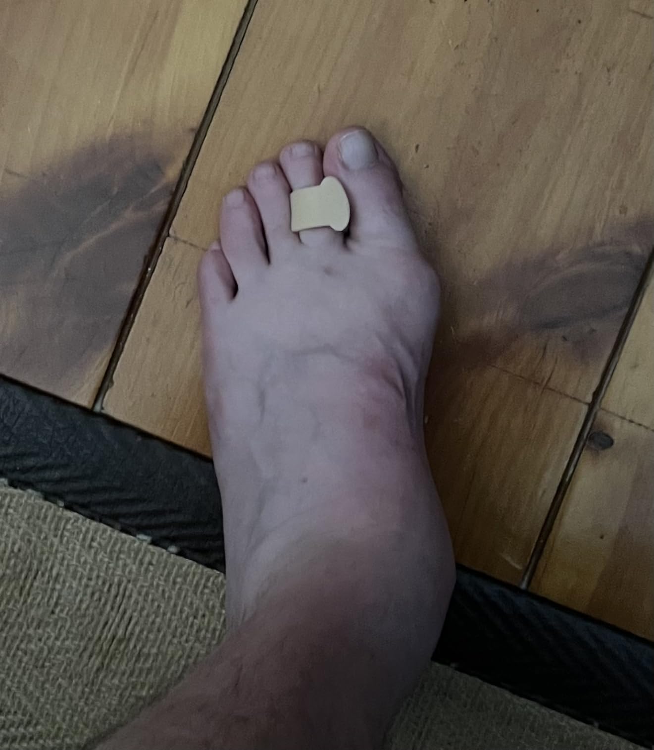 ZenToes Gel Toe Spacers for Bunions & Overlapping Toes, 4 Count | Gel toe separators for women & men. Big toe alignment, crooked toes. Fits sneakers, sandals & heels. Washable customer photo 2