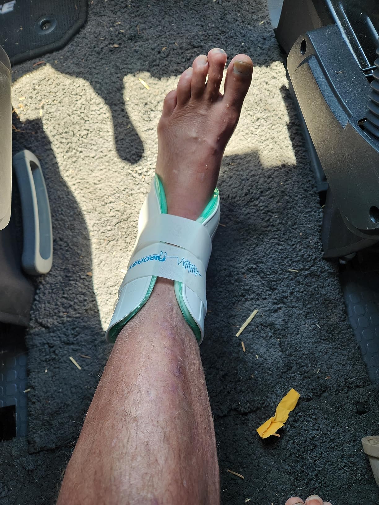 Aircast Air-Stirrup Ankle Support Brace customer photo 1