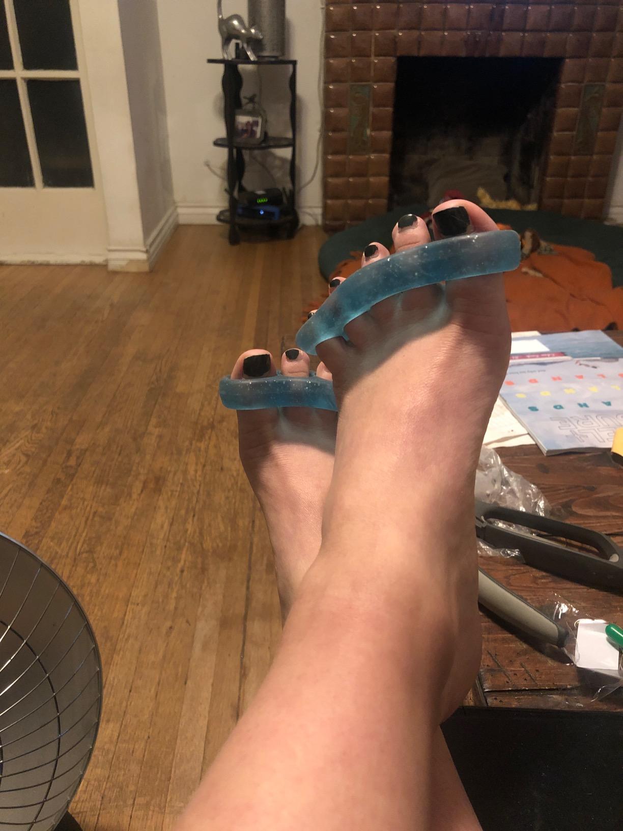 DR. JK- ToePal Gel Toe Separator, 2 Pairs, Toe Spacers, Toe Straightener, Hammer Toe Straightener, Toe Spreader, Toe Stretcher, Toe Corrector for Women and Men, Bunion Corrector customer photo 1