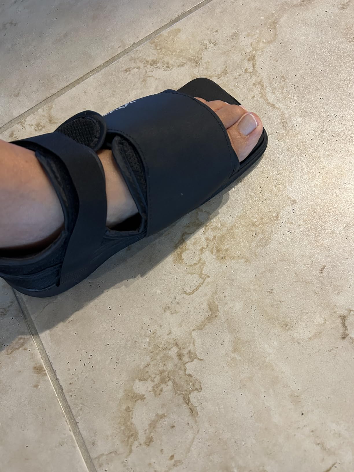 Vive Post Op Shoe - Lightweight Medical Walking Boot with Adjustable Strap | Orthopedic Recovery Cast Shoe for Post Surgery, Fractured Foot, Injured Toes, Stress Fracture, Sprains - Left or Right Foot customer photo 2