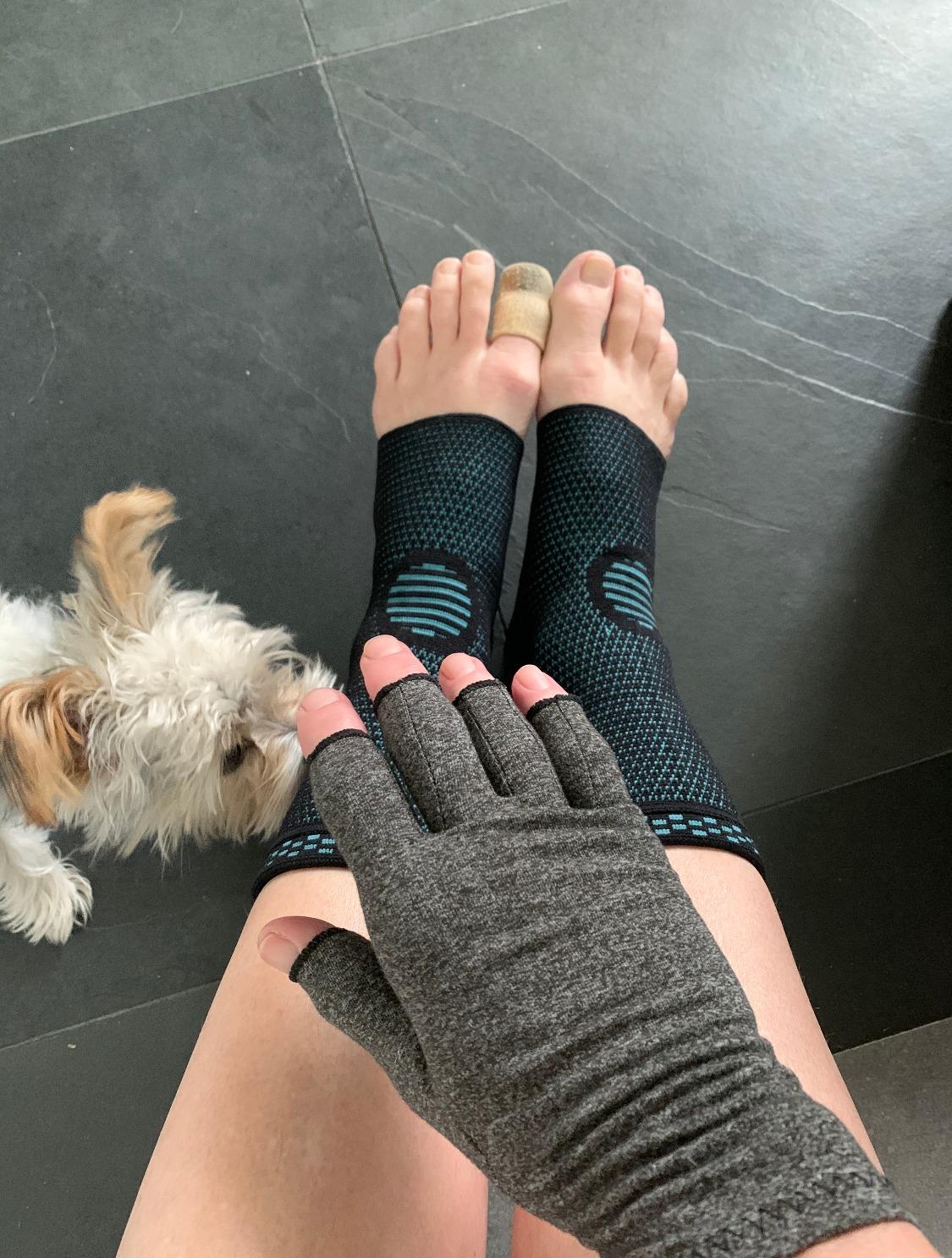 ComfyBrace Copper Arthritis Gloves, Hand Compression Gloves for Women & Men | Fingerless Compression Gloves for Swelling, Carpal Tunnel, Trigger Finger, Tendonitis and Rheumatoid Arthritis Pain Relief customer photo 1