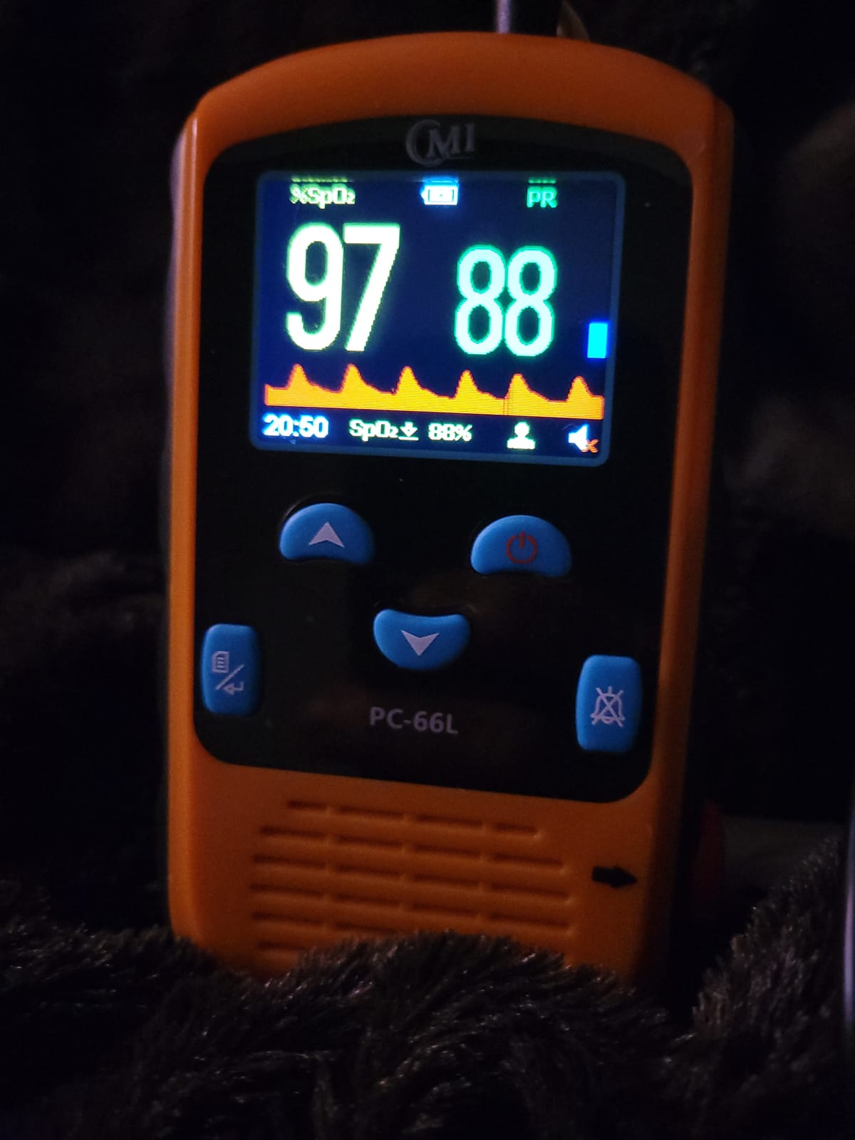 CMI Health Rechargeable Finger Pulse Oximeter for Adults, Continuous SpO2 & Pulse Rate Readings customer photo 2