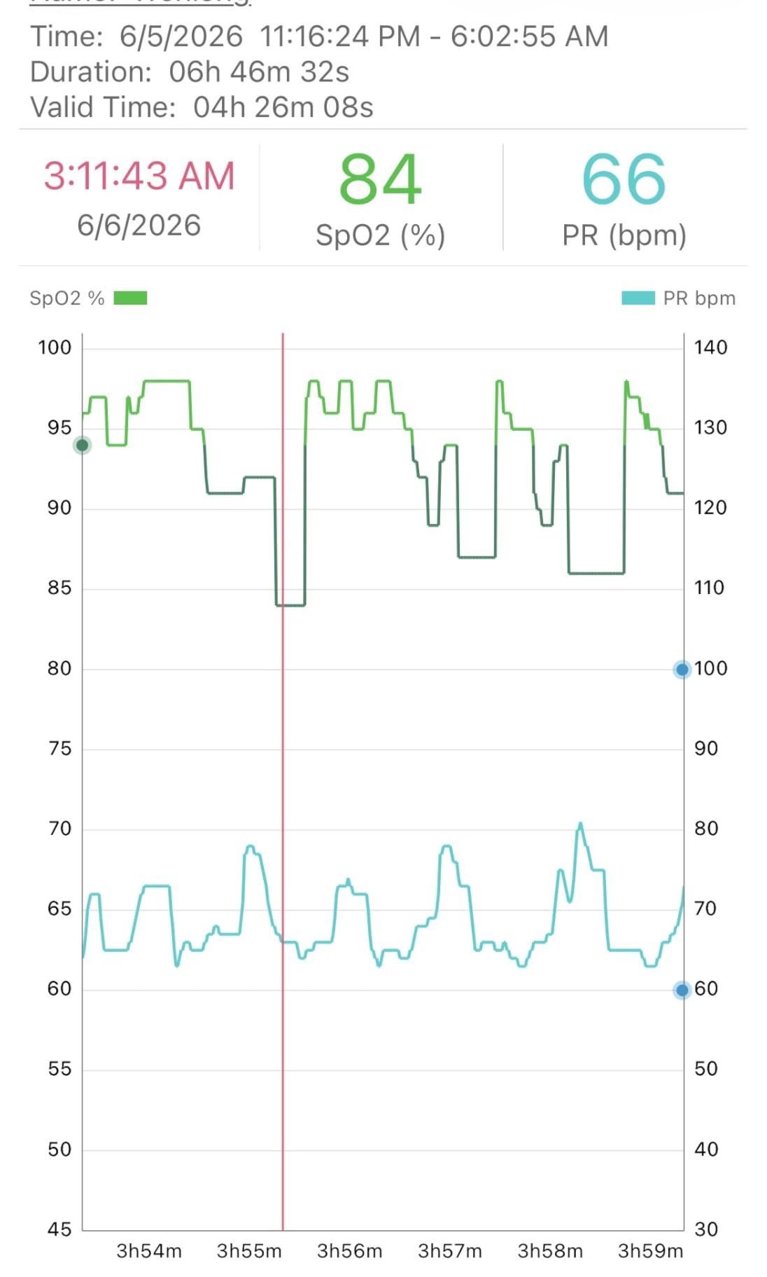 EMAY Sleep Oxygen Monitor with Built-in Recording Capability customer photo 1