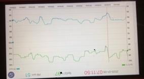 EMAY Sleep Oxygen Monitor with Built-in Recording Capability customer photo 2