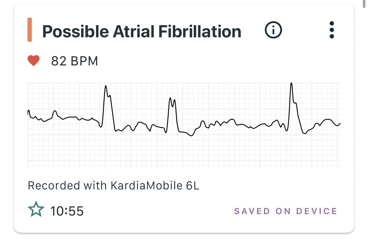 KardiaMobile 6L EKG, No Membership Required, Unlimited Recordings, HSA/FSA | Detects 4 Arrhythmias, FDA-Cleared Heart Monitor, Medical-Grade Results in 30 Seconds, Works with Smartphones and Tablets customer photo 2