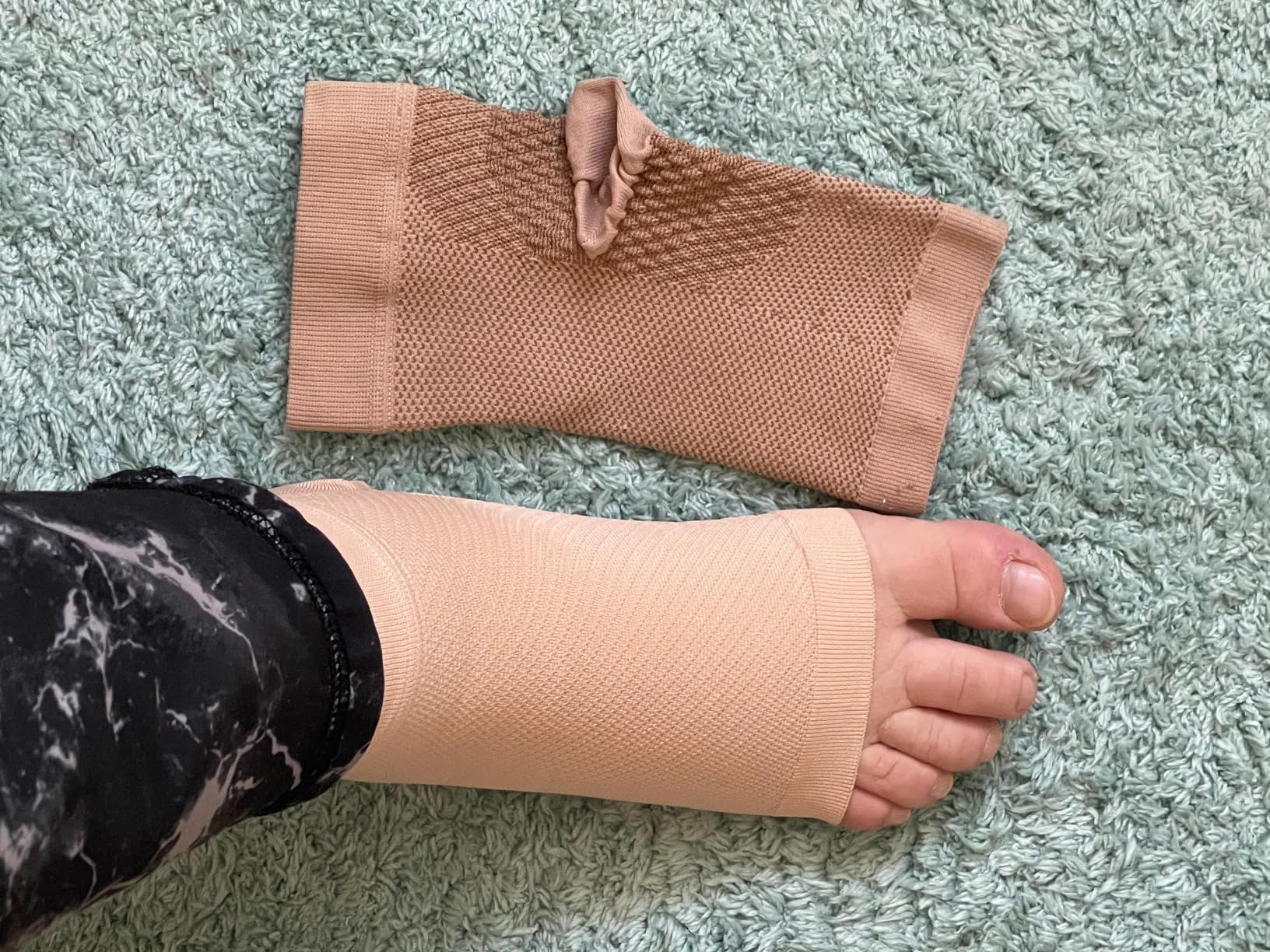 KEMFORD Ankle Compression Sleeve - 1-Pair, Plantar Fasciitis Braces - Open Toe Compression Socks for Swelling, Sprain, Neuropathy, Foot Arch Support for Men and Women - 20-30mmhg, M, Beige customer photo 2