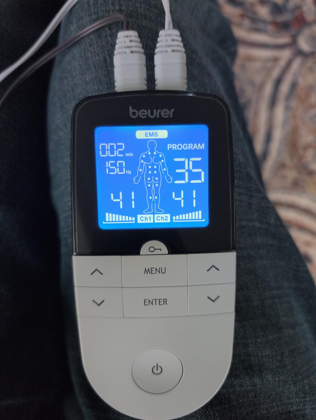 Beurer EM59 Digital 3-in-1 TENS Unit, EMS & Heat Therapy for Pain Relief & Relaxation, Muscle Stimulator with 2 Adjustable Channels, 64 Applications, Timer Function customer photo 1