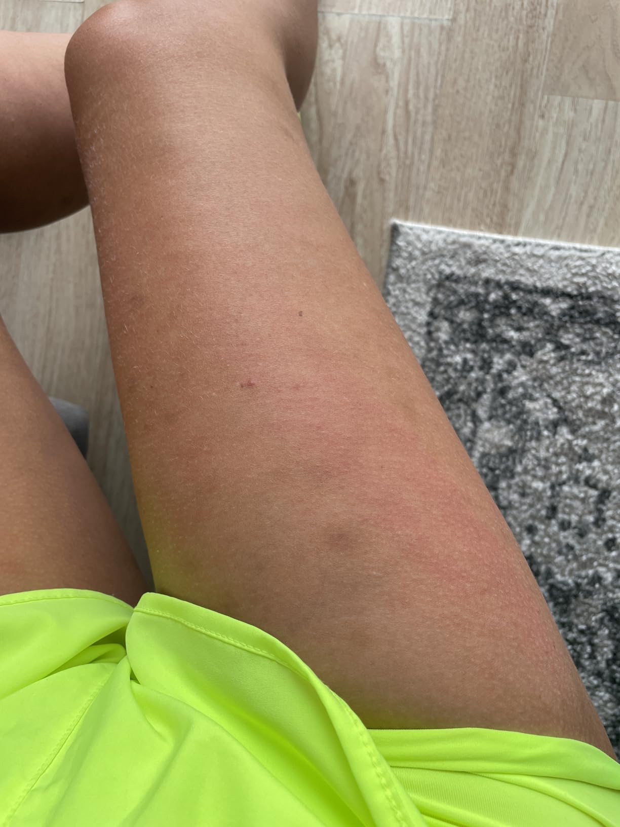 TESMED Cellulite Manual Massager Roller for Thighs and Buttocks | Made in Italy and patented, with converging and diverging roller technology for targeted anti-cellulite massage. customer photo 1