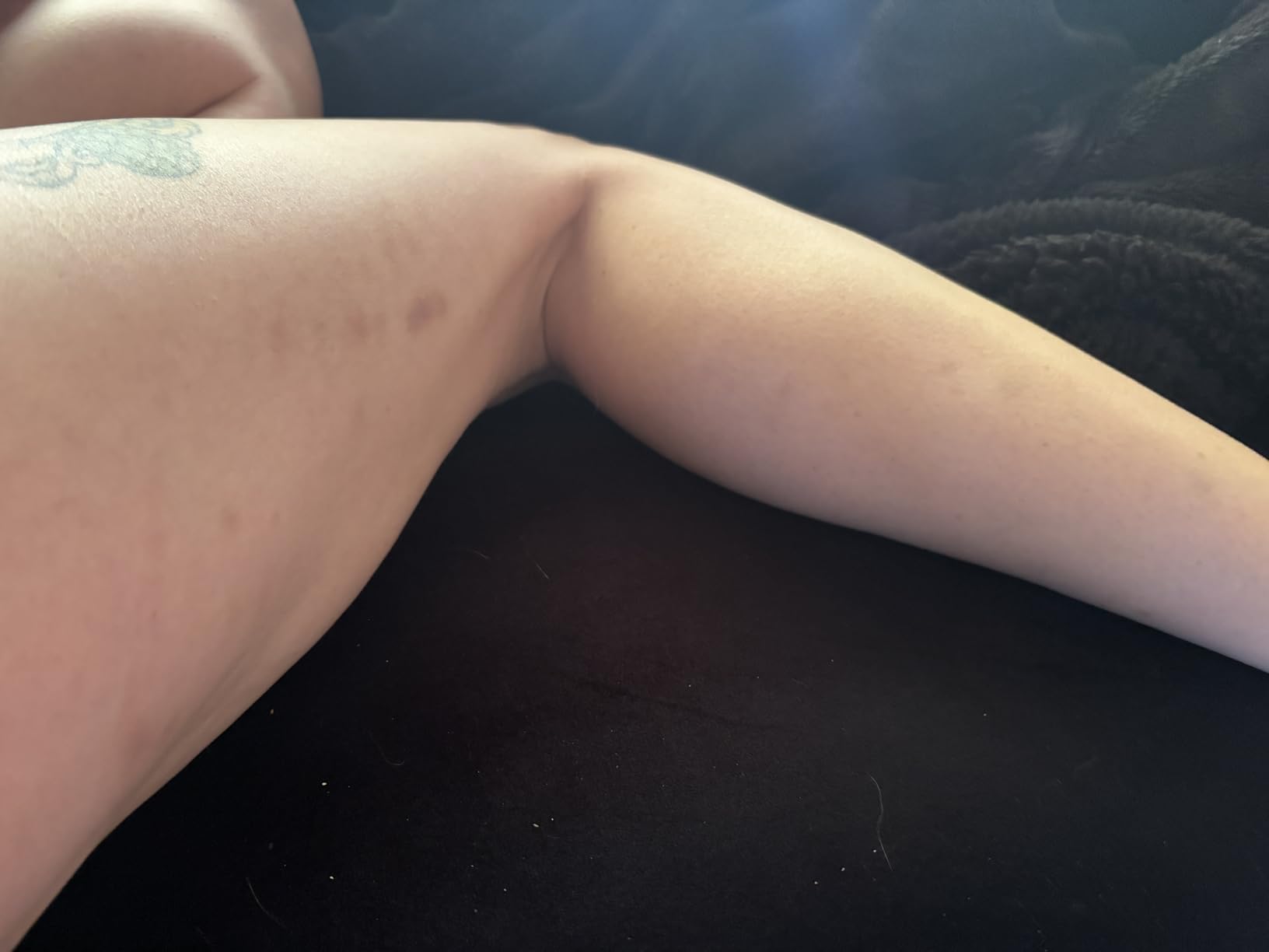 TESMED Cellulite Manual Massager Roller for Thighs and Buttocks | Made in Italy and patented, with converging and diverging roller technology for targeted anti-cellulite massage. customer photo 2