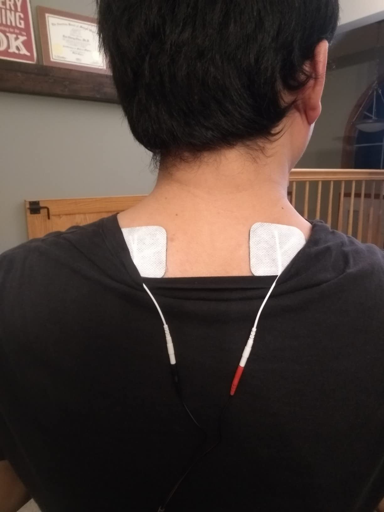 iStim TENS EMS Muscle Stimulator, EV-906 for Pain Relief and Muscle Strengthening, Japanese Gelled Electrodes Included customer photo 1