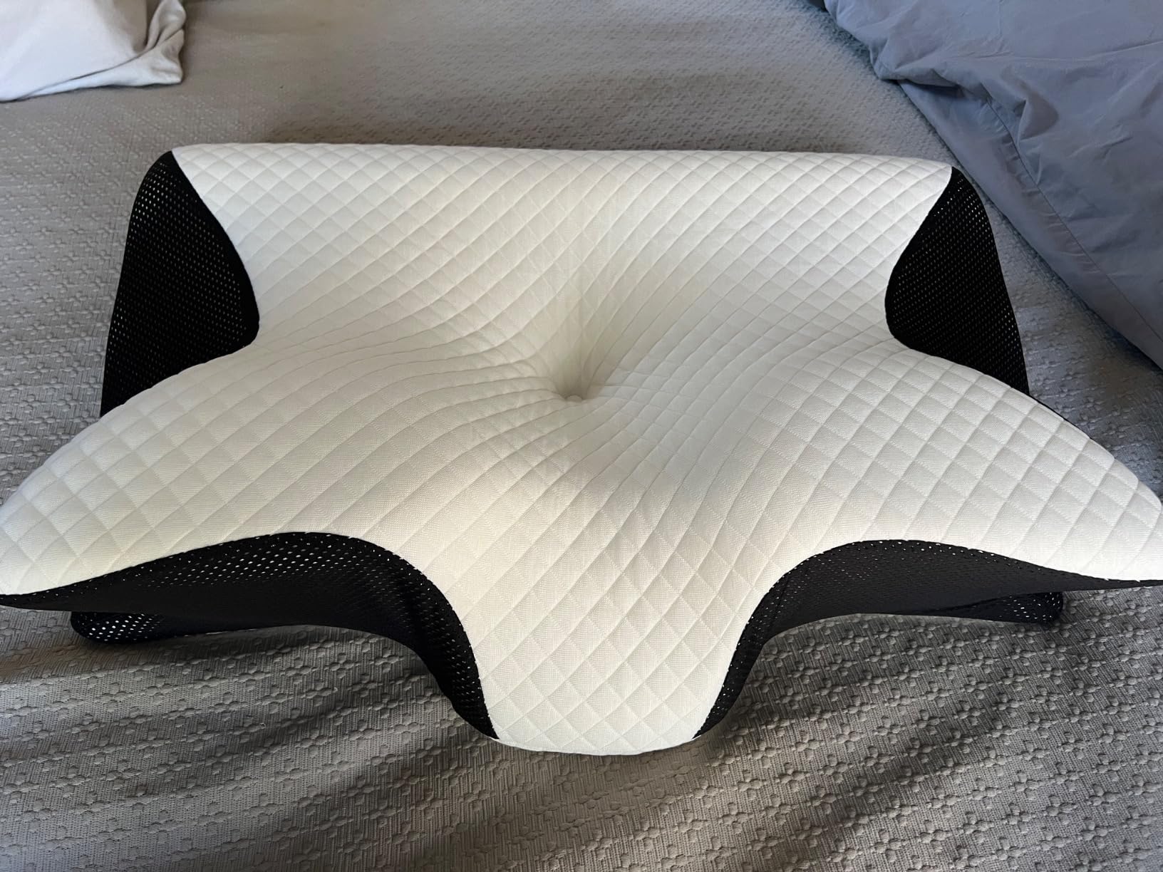 HOMCA Memory Foam Cervical Pillow, 2 in 1 Ergonomic Contour Orthopedic Pillow for Neck Pain, Contoured Support Pillows for Side Back Stomach Sleepers customer photo 1