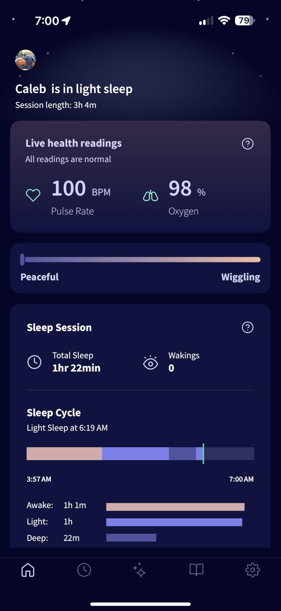 Owlet Dream Sock Smart Baby Monitor, Better Sleep for Baby & You | FDA-Cleared Monitor, Tracks Pulse Rate & Oxygen With Real-Time Alerts, Predicts Sleep Patterns, New Parent Essential customer photo 1