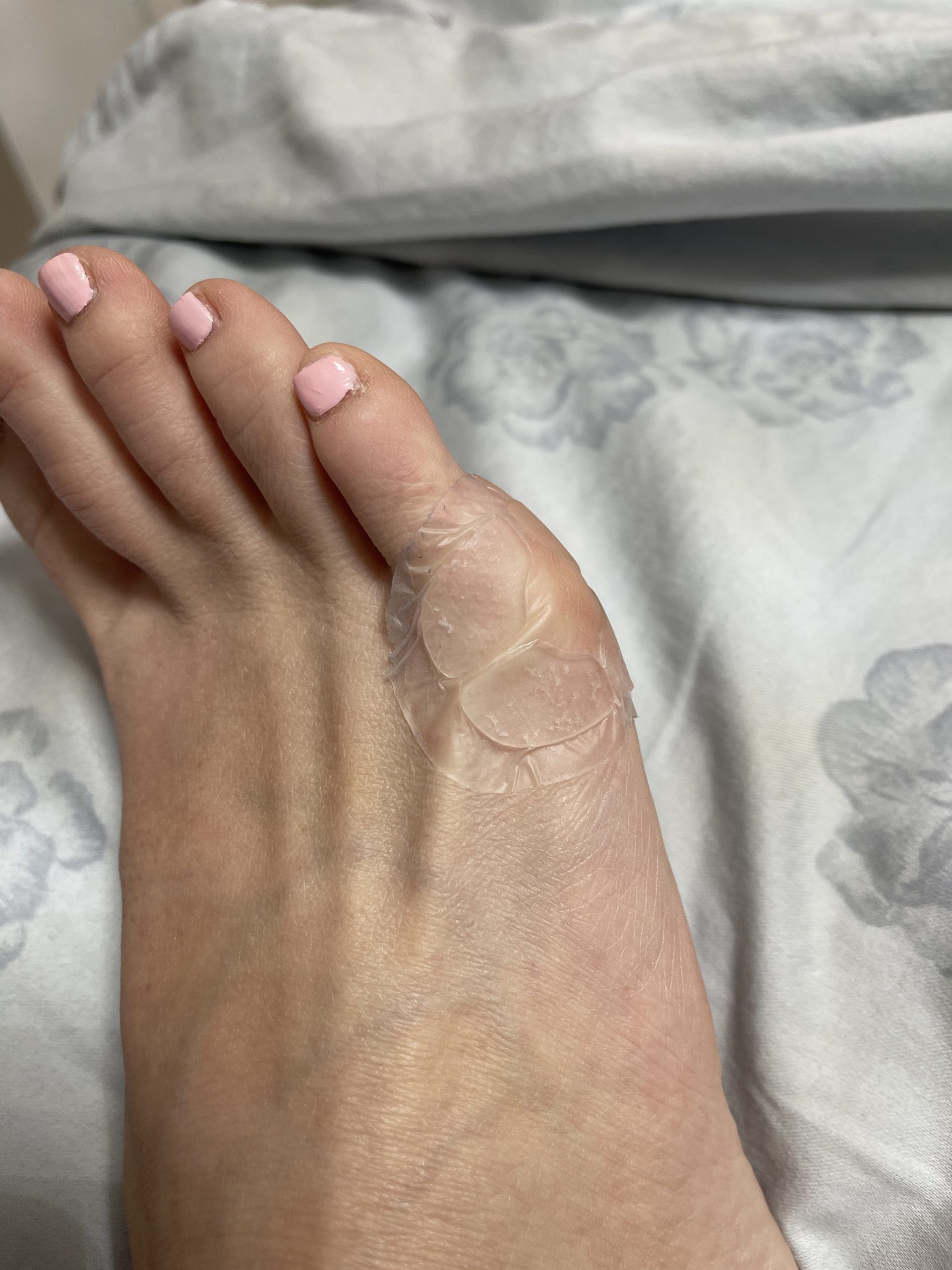 Dr. Scholl's Duragel Bunion Cushion (Pack of 3, 15 Count Total) customer photo 1