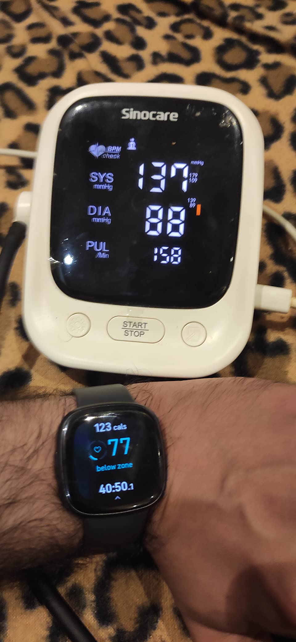 Fitbit Sense 2 Health and Fitness Smartwatch - Shadow Grey/Graphite customer photo 1