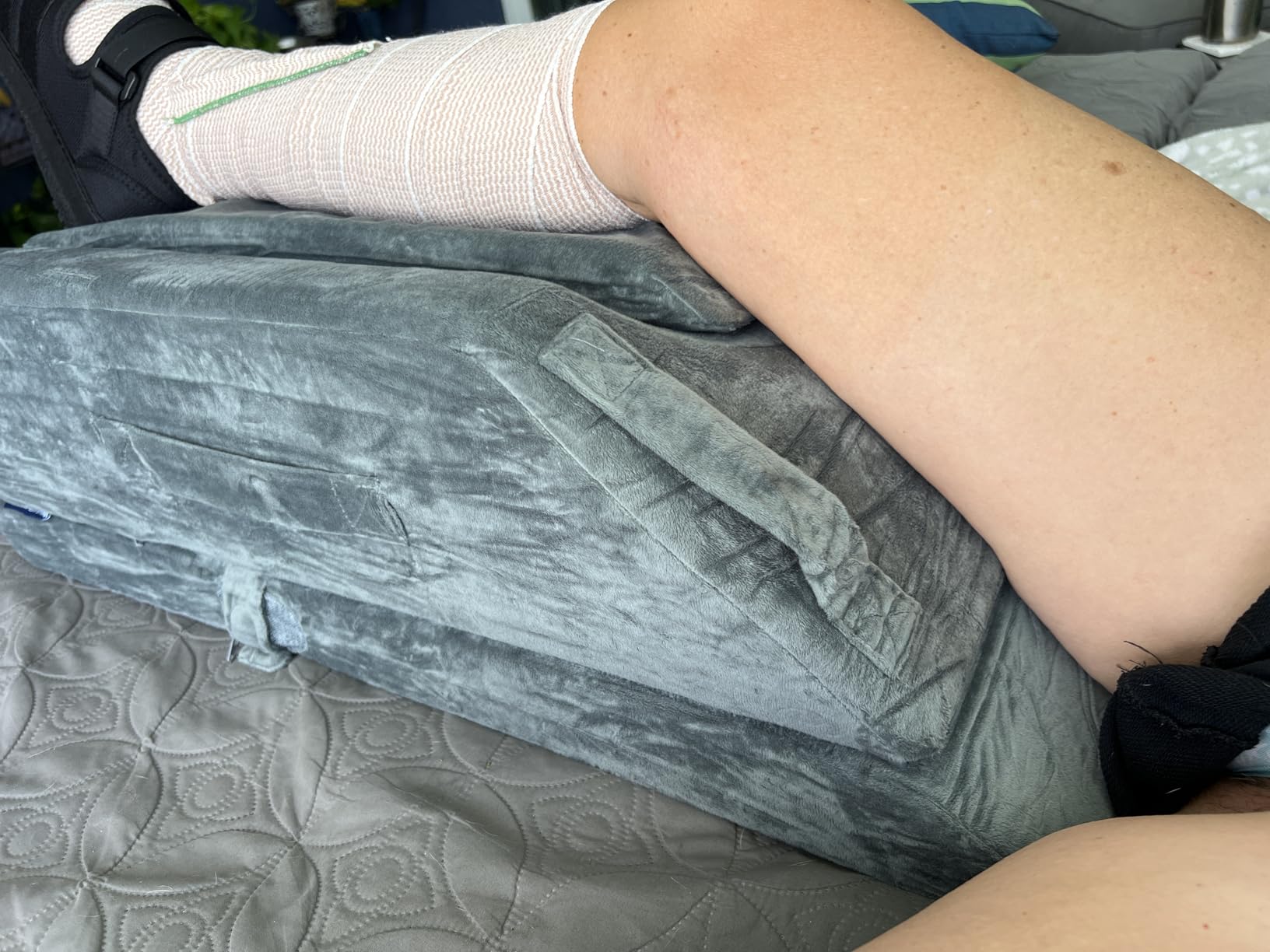 KingPavonini 4-Height Adjustable Leg Elevation Pillows for After Surgery, Injuries, or Rest, Memory Foam Leg Pillows for Sleeping with 3 Handles and Insert Pad, Washable Velvet Cover customer photo 2