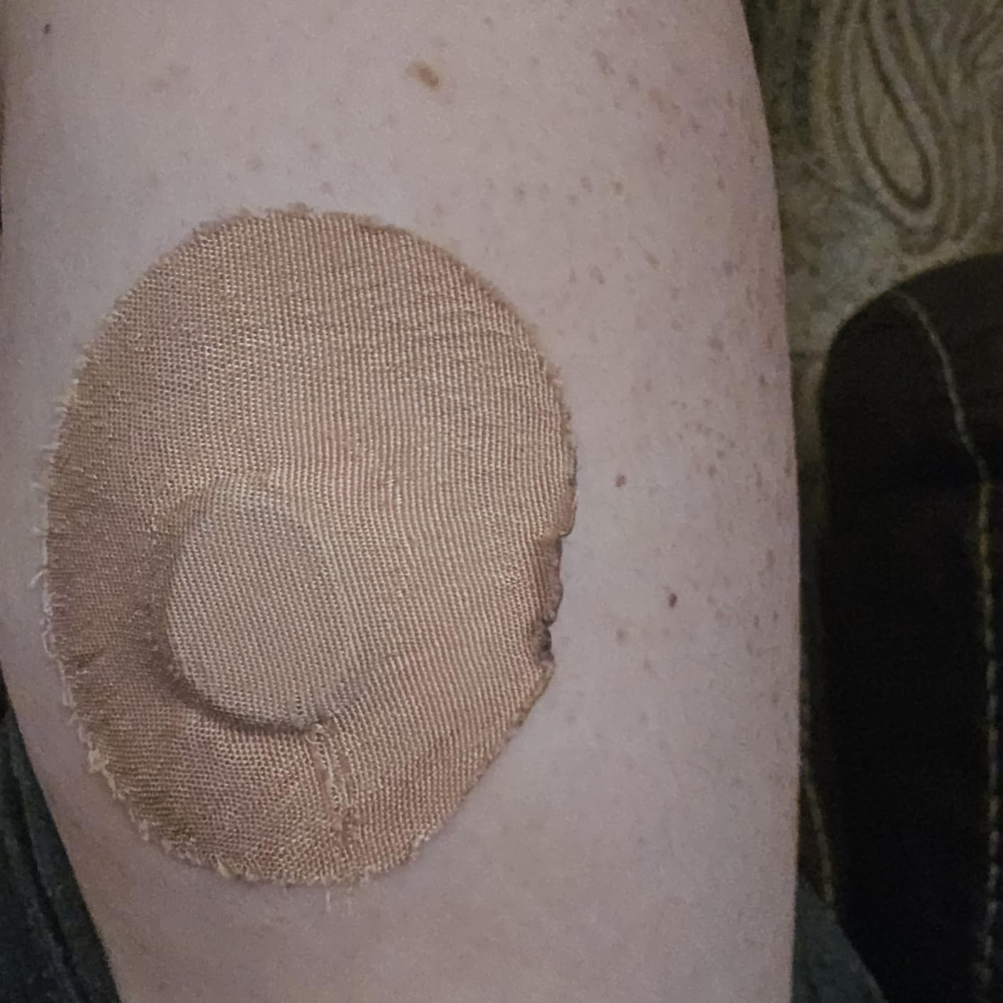Skin Grip Adhesive Patches Compatible with Dexcom G7 & Stelo CGM Sensors | Waterproof & Sweatproof Cover for Continuous Glucose Monitor Sensor, Strong Hold, 15+ Days of Grip, 20 Pack, Tan customer photo 1