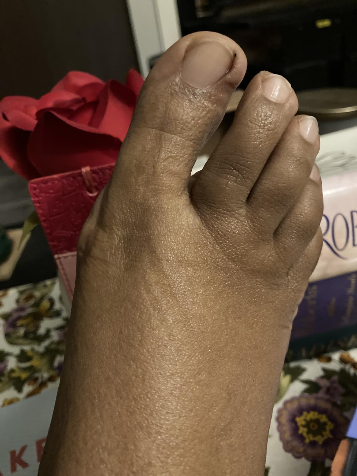 Dr. Scholl's BUNION RELIEF & TOE CORRECTOR // Massaging Gel Bunion Splint & Big Toe Straightener - Orthopedic Bunion Corrector for Women & Men - Bunion Pads for Bunion Pain Relief, 1 Support Set (Left & Right) customer photo 1