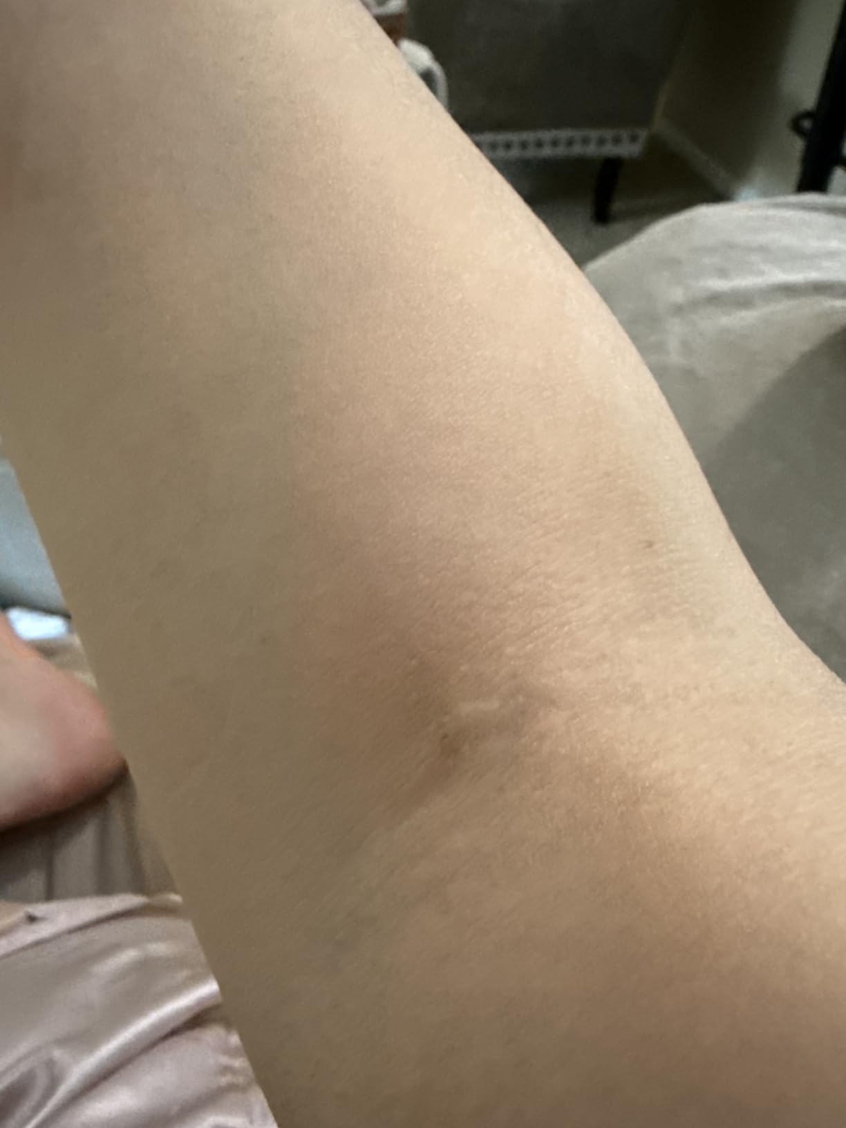 Solawave 4-in-1 Red Light Therapy Wand for Face & Neck (Rose Gold) | FDA-cleared for face wrinkles. Red Light Therapy, Galvanic Current, Warmth & Massage work together for firmer, glowing skin. customer photo 1
