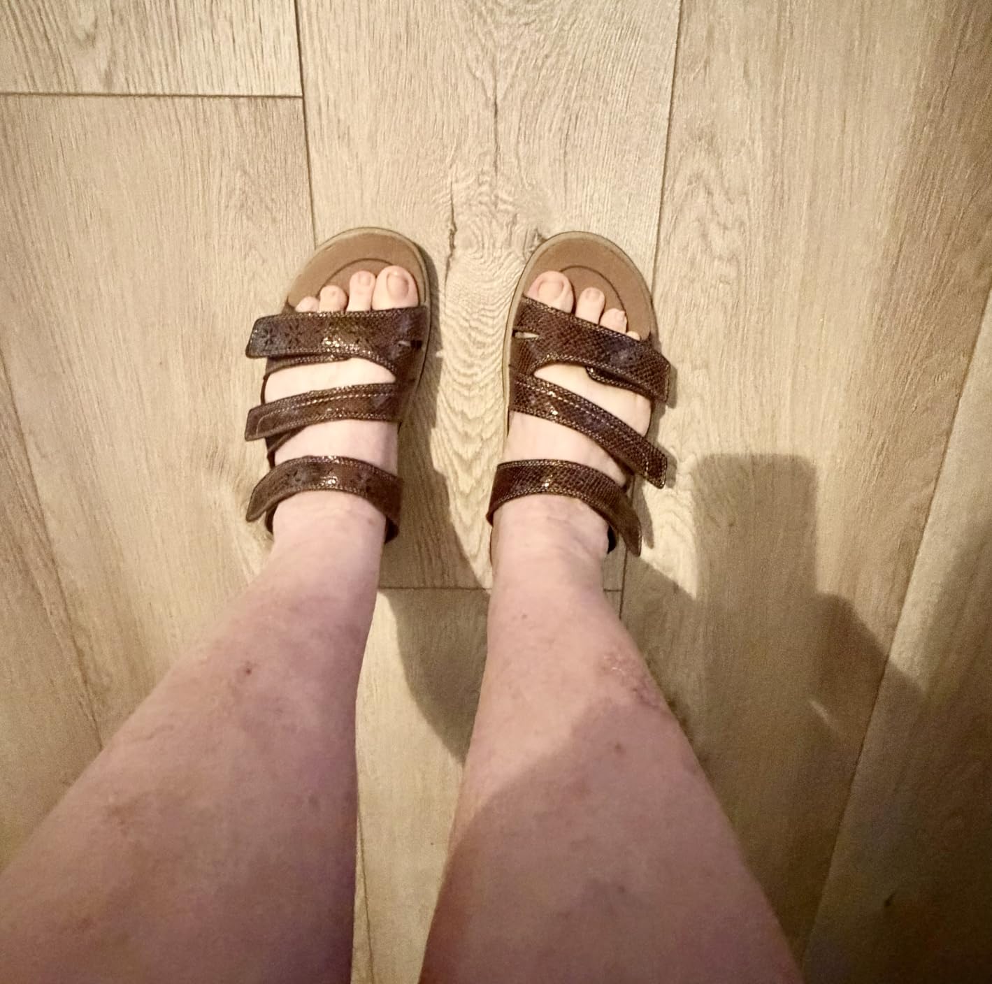 Orthofeet Sahara Orthopedic Women Sandals customer photo 2