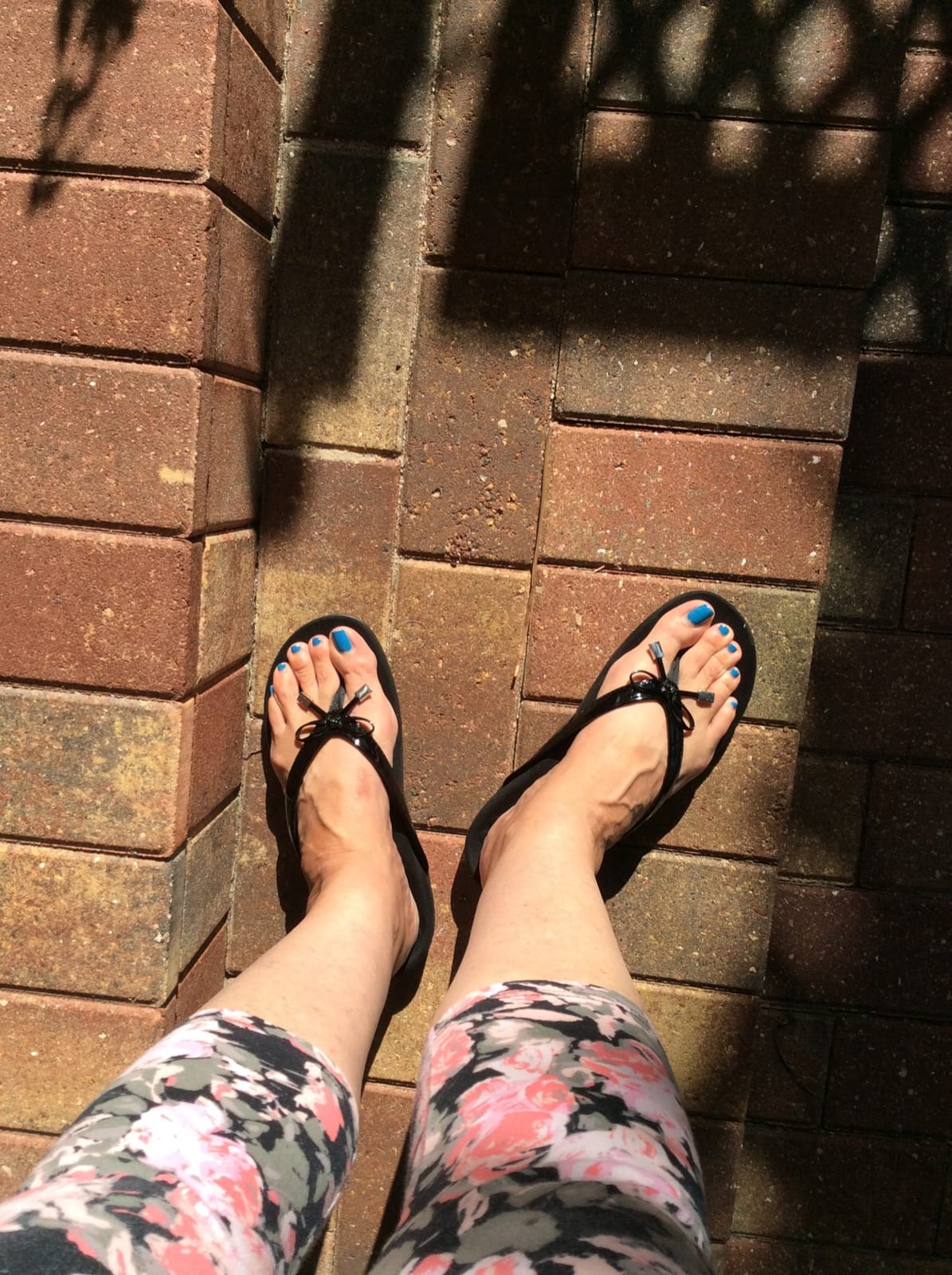 Vionic Women's Rest Bella Toe Post Sandal- Supportive Ladies Orthotic Sandals that include Three Zone Comfort with Arch Support- Flip Flop for Ladies, Medium and Wide Width Size 5-12 customer photo 1