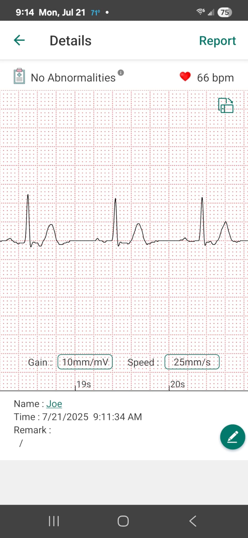 EMAY Portable ECG Monitor | Record ECG and Heart Rate | Compatible with Smartphone and PC customer photo 1