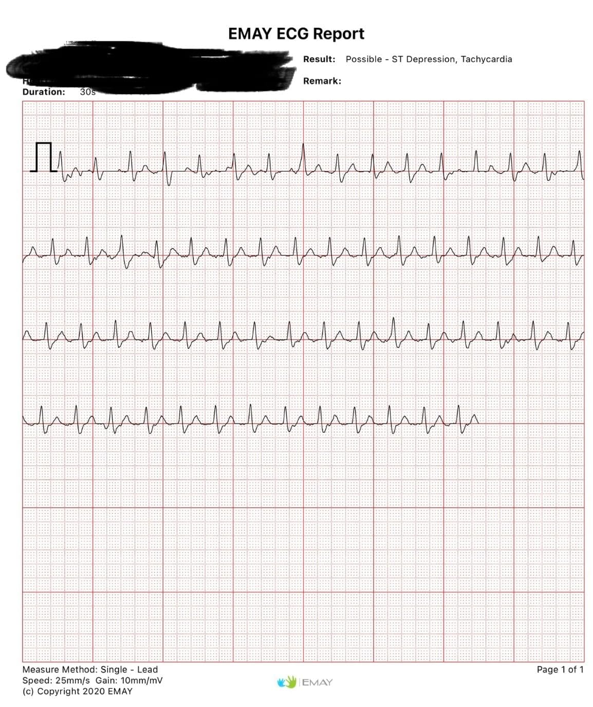EMAY 6L Portable ECG Monitor | Record ECG and Heart Rate in 6 Channels | Compatible with Smartphone and PC | No Subscription Required customer photo 2