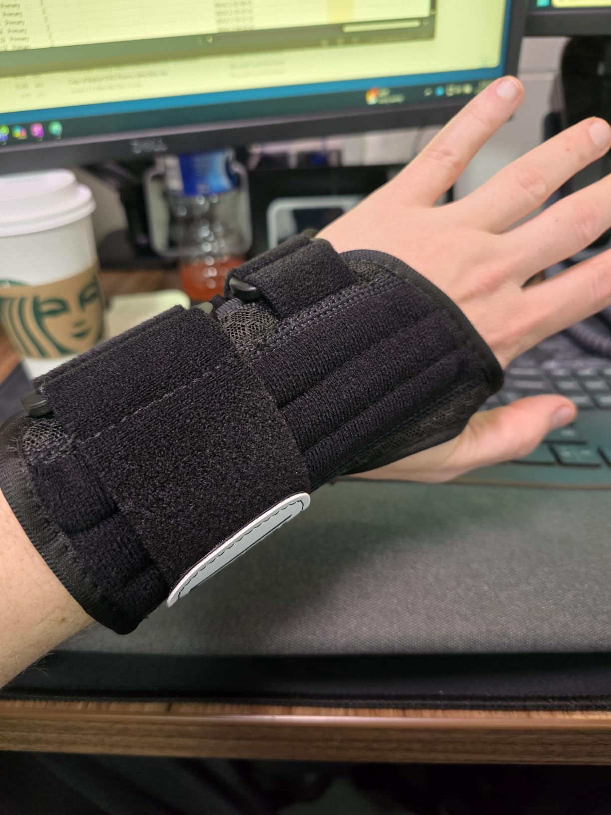 FEATOL 2 Pack Carpal Tunnel Wrist Brace For Work With Wrist Splint, 6.5'' Wrist Brace Night Support For Women Men, Pain Relief For Tendonitis, Arthritis, Pregnancy, Typing, Right and Left Hand, Medium customer photo 1