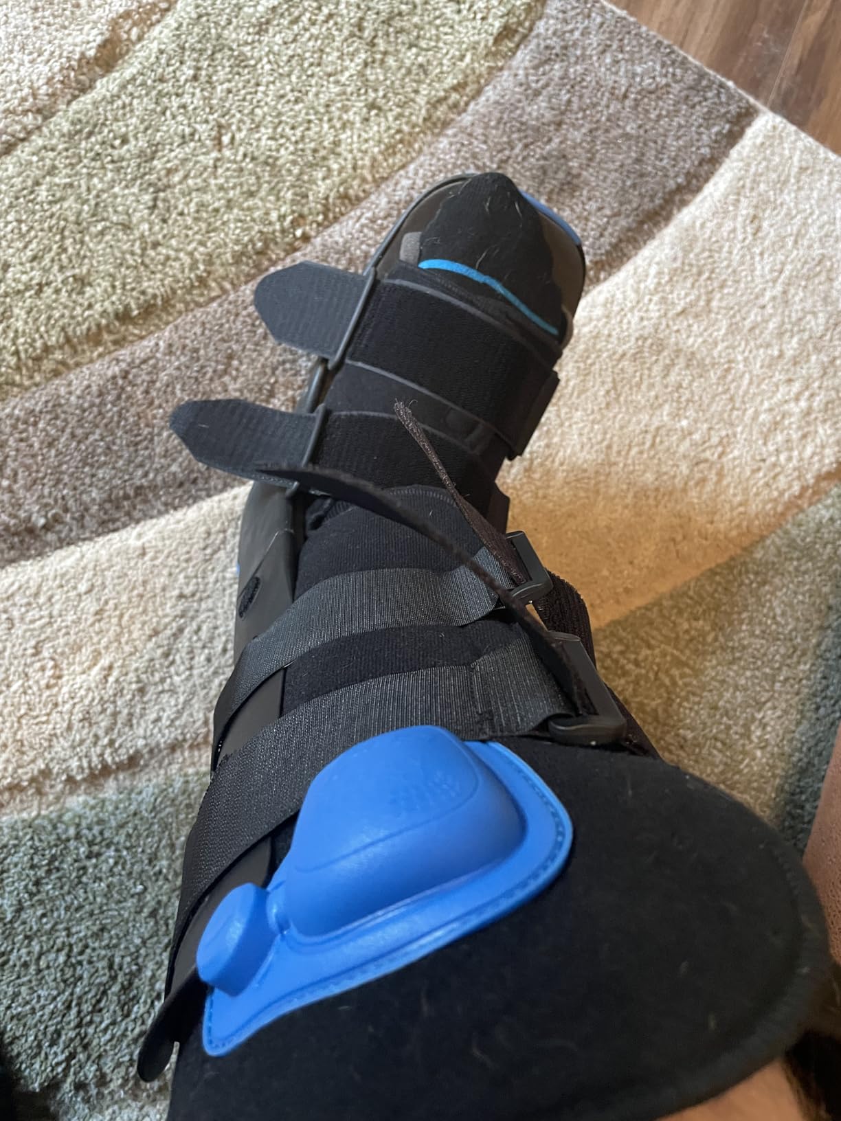 Ovation Medical Gen 2 Pneumatic Walking Boot - Lightweight, Low Profile CAM Walker Boot - Premium Medical Boot for Foot Injuries, Ankle Sprains, Fracture Recovery Support, & More (Standard, Medium) customer photo 2