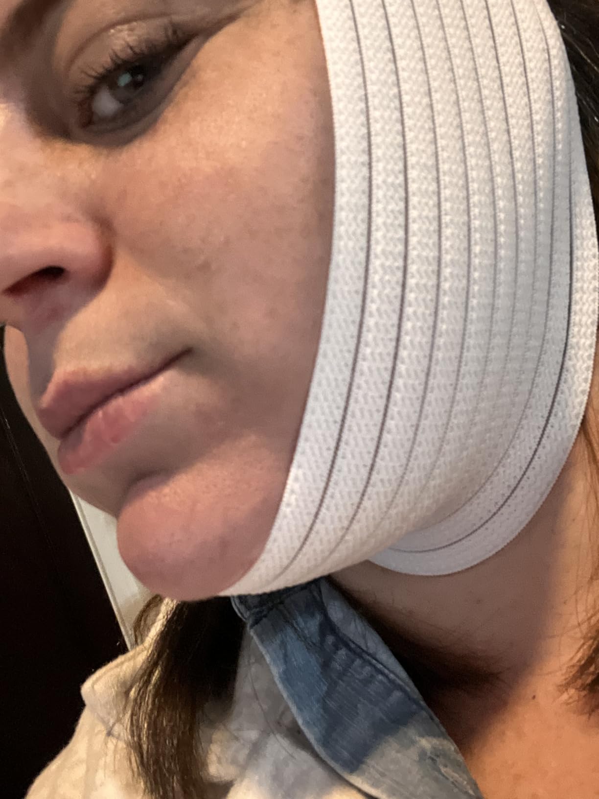 Bistras Super Deluxe White Chin Strap for Cpap Users - Anti Dry Mouth- Anti Snore Chin Strap Great Sleeping Solution for Men and Women to Keep Mouth Closed While Sleeping (1 pk) customer photo 1