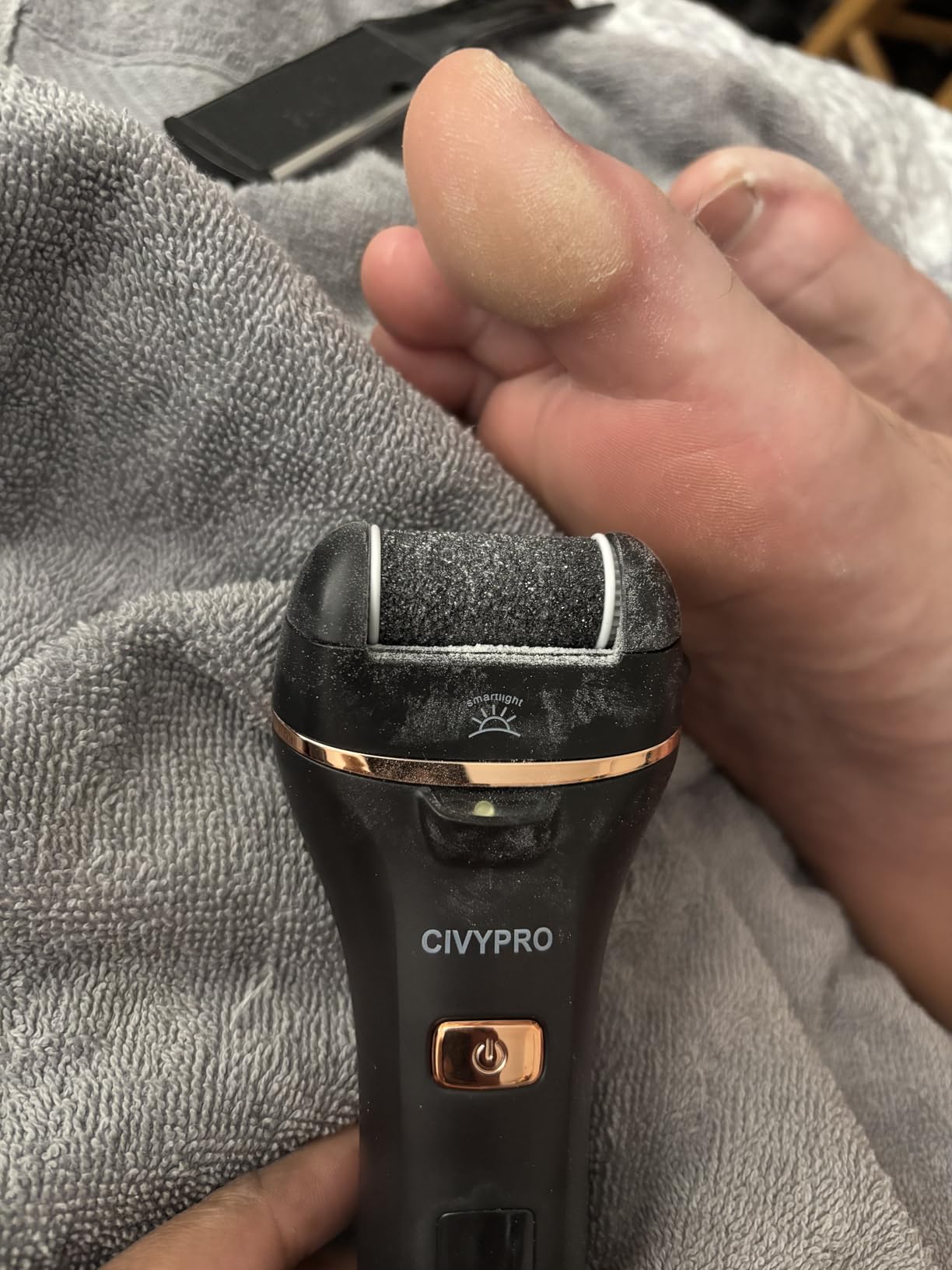 Electric Foot Callus Remover - Rechargeable Electronic Foot File, Waterproof Foot Scrubber, Pedicure Kit for Dead Skin (Black) customer photo 2