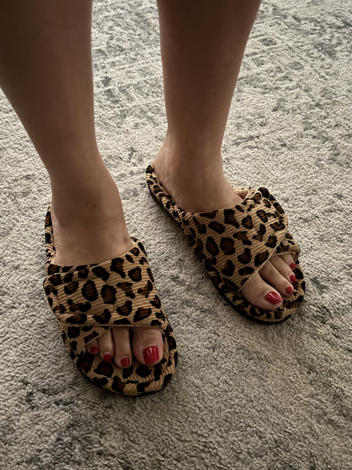 Litfun Orthopedic Slippers for Women Arch Support House Shoes customer photo 1