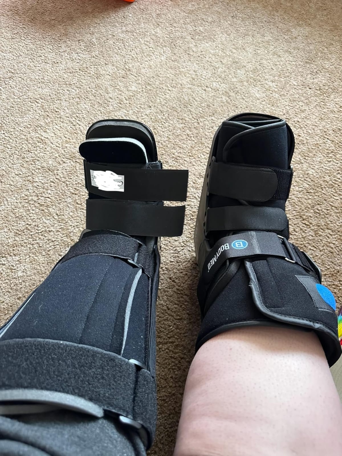 BodyMed Air CAM Walking Fracture Boot, Medium, 12.3