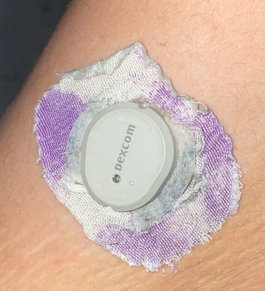 Skin Grip Adhesive Patches Compatible with Dexcom G7 & Stelo CGM with Cutout | Waterproof & Sweatproof Cover for Continuous Glucose Monitor Sensor, Strong Grip for 15+ Days, 10 Pack, Floral customer photo 2