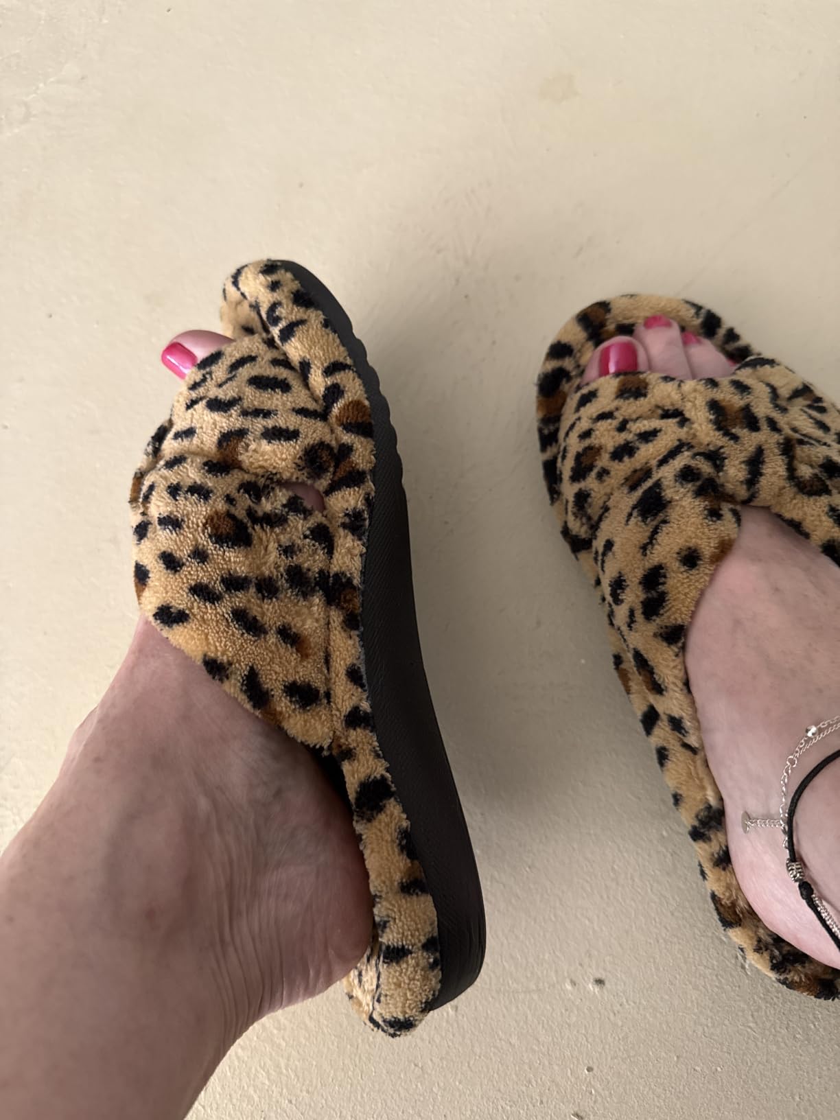 Women's Orthopedic Arch Support Slippers for Plantar Fasciitis customer photo 2