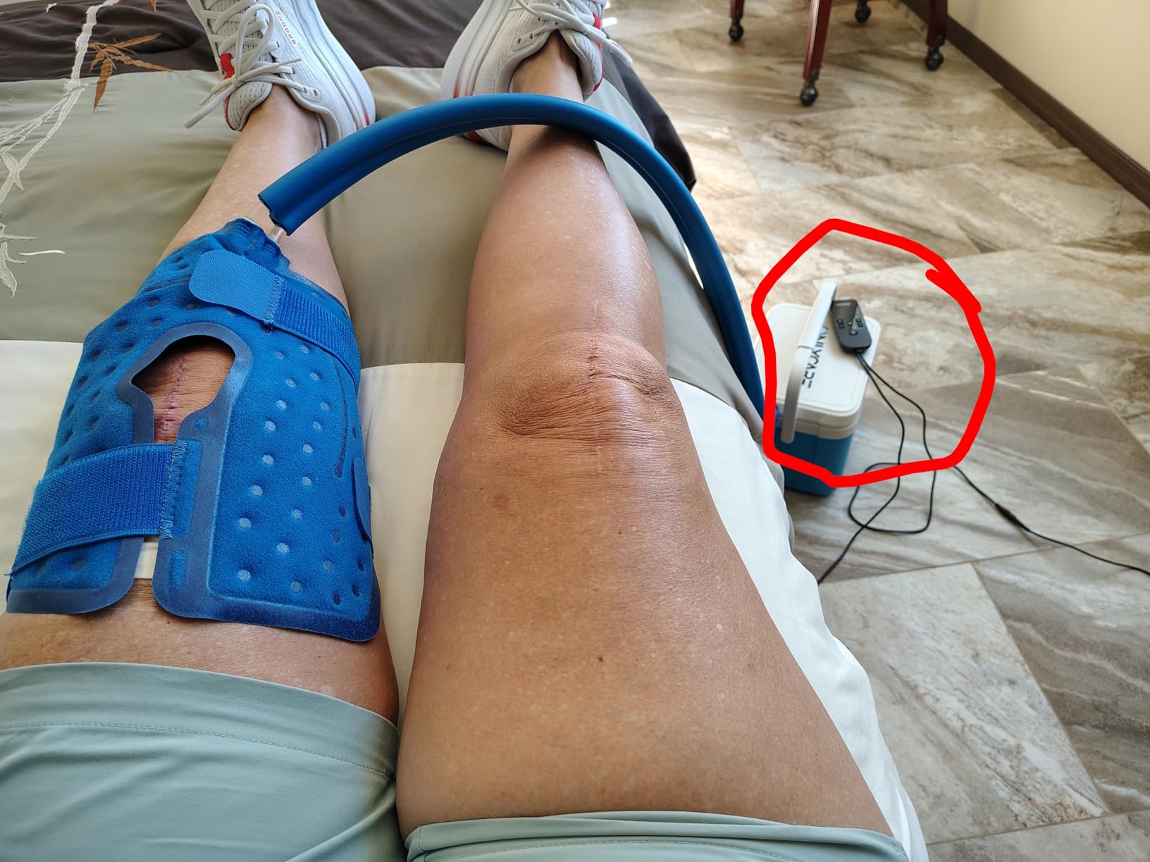 ONLYCARE Ice Machine for Knee After Surgery, Portable Cold Therapy Machine with Program Timer, Quiet Pump, Cold Compress Pad for Ankle Arm Joints Sports Injuries Cryotherapy Machine customer photo 1