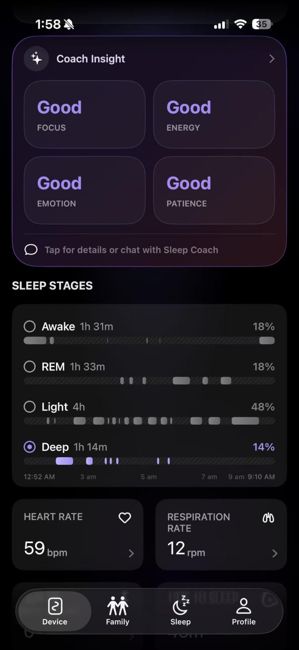 OZI Smart Sleep Tracker, Non-Wearable Contactless Under-Sheet Sleep Monitor | Tracks Sleep Stages, Heart Rate, Breathing, Movement, and Bed-Exit in Real-Time customer photo 1