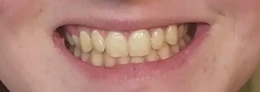 Opalescence Whitening Toothpaste Original 4.7oz - Mint - 1 Pack - 5166-T customer photo 2