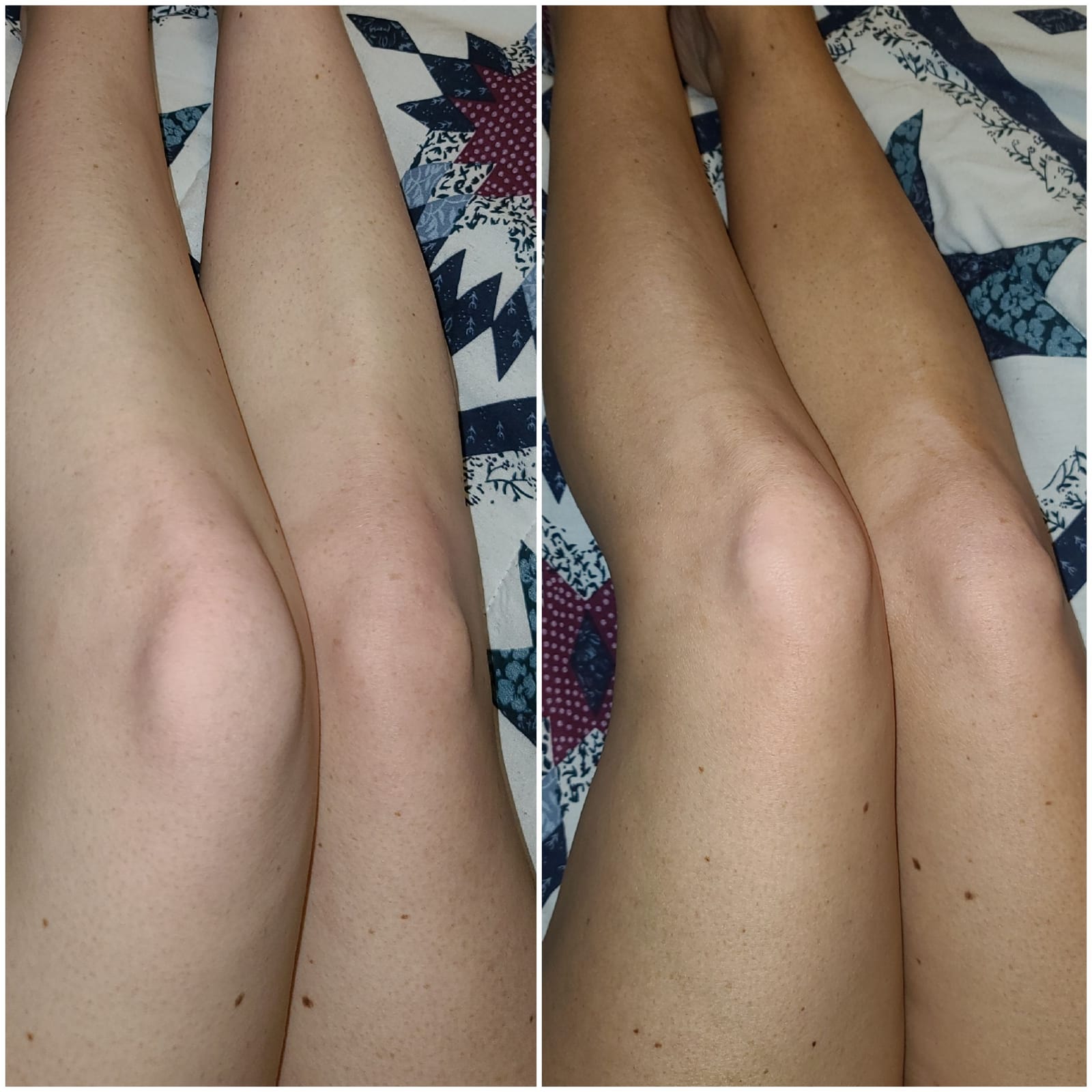 St.Tropez Self Tan Classic Bronzing Mousse for Natural Sunless Tan customer photo 1