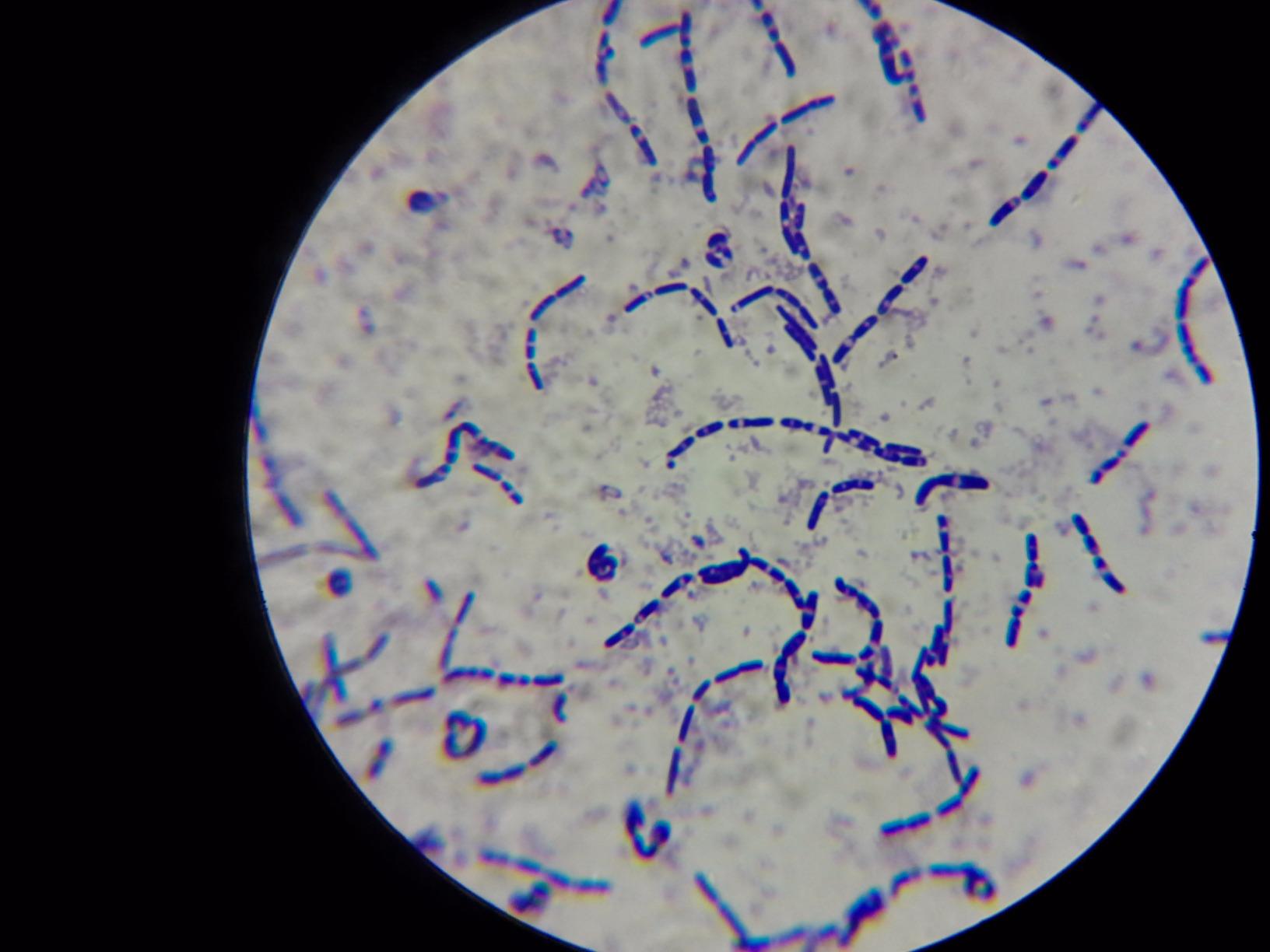 OMAX M82ES-SC100-LP100-OM 2000X LED Binocular Compound Lab Microscope customer photo 2