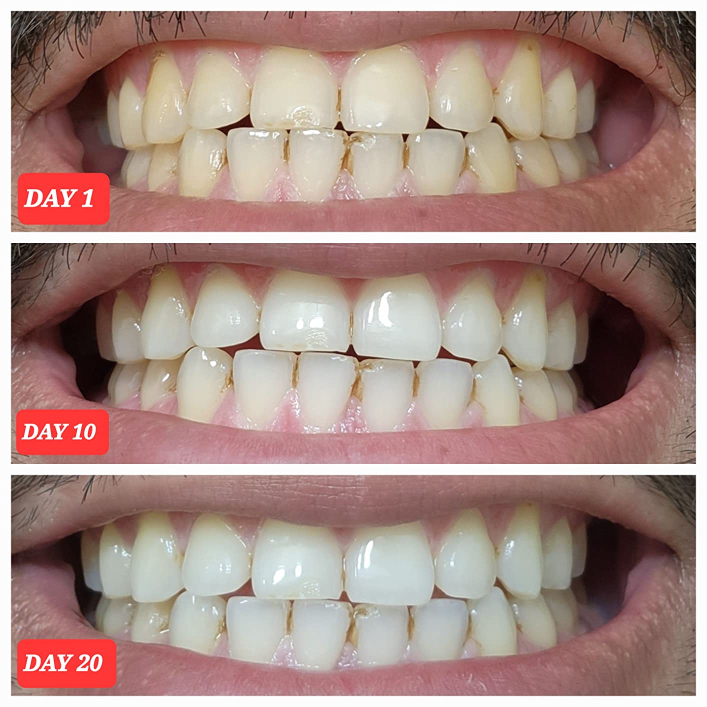Crest Teeth Whitening Strips, Crest 3D Whitestrips Professional Effects, Enamel Safe Teeth Whitening Kit, 22 Treatments (44 Strips), Professional-Level Whitening, 19 Levels Whiter customer photo 2
