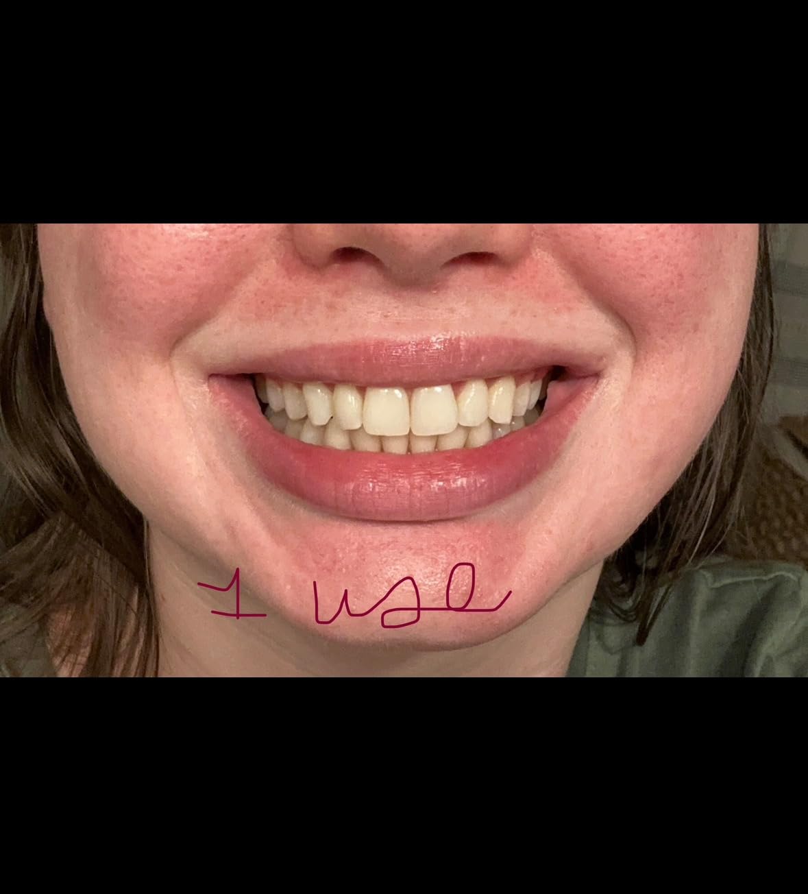 Lovely Smile Premium Line Teeth Whitening Strips - Enamel Safe - White Teeth in 1 Hour - No Slip and No Sensitivity - Dental Whitener Kit by Ray of Smile (28 Strips/Mint) customer photo 1