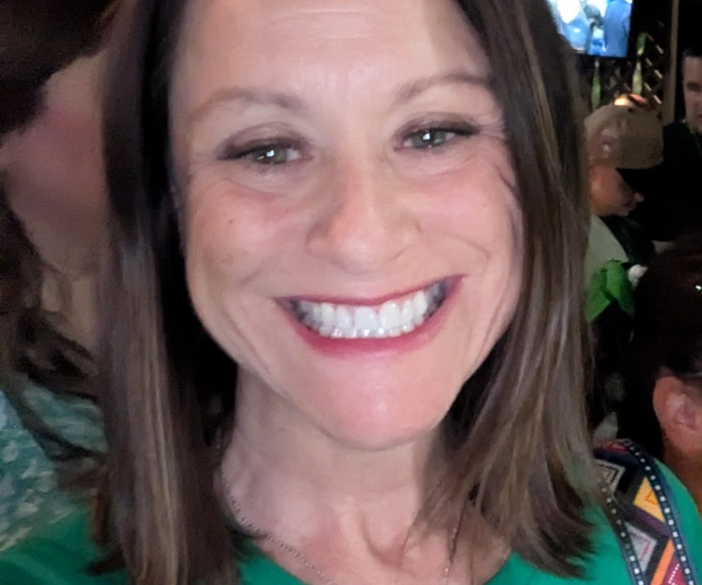 Lovely Smile Premium Line Teeth Whitening Strips - Enamel Safe - White Teeth in 1 Hour - No Slip and No Sensitivity - Dental Whitener Kit by Ray of Smile (28 Strips/Mint) customer photo 2