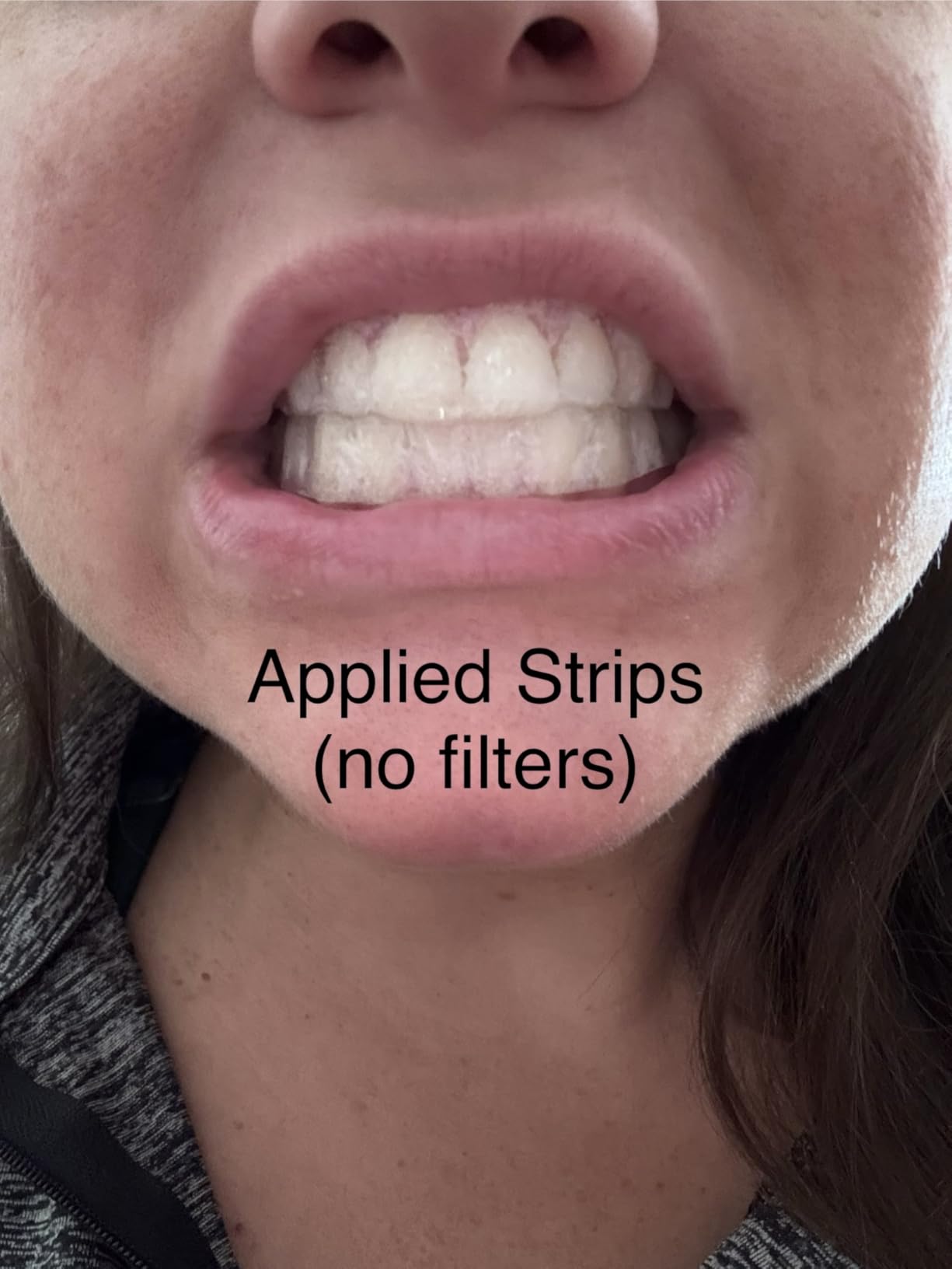 PERSMAX Teeth Whitening Strips – 14 Treatment, 28 Non-Slip Strips customer photo 1