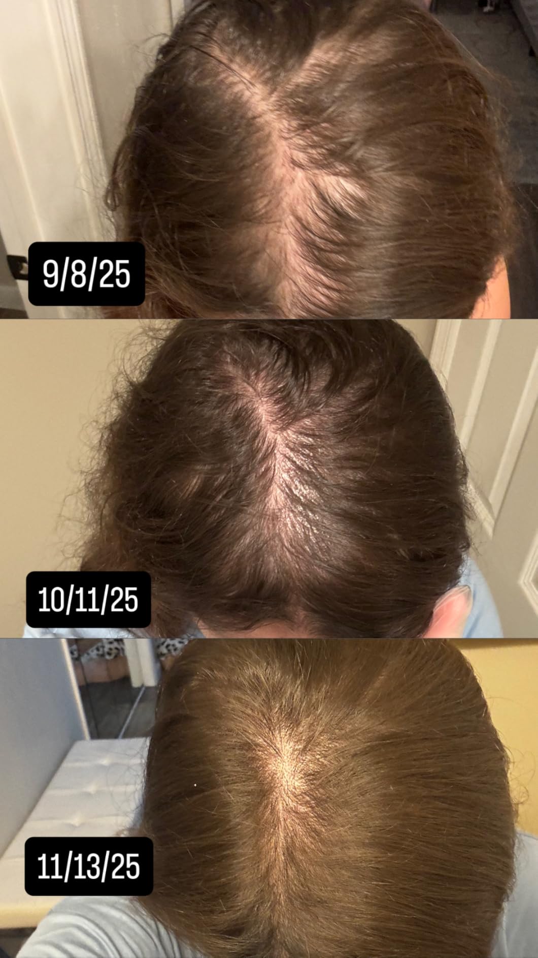The Ordinary Multi-Peptide Serum for Hair Density, Peptide-Powered Formula for Thicker, Fuller Looking Hair customer photo 1