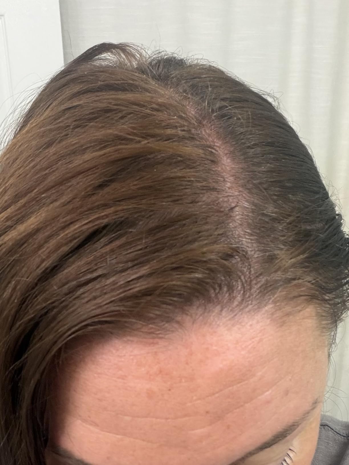 K18 AirWash™ Dry Shampoo, Non-Aerosol, Balances Scalp & Controls Excess Oil Production customer photo 2